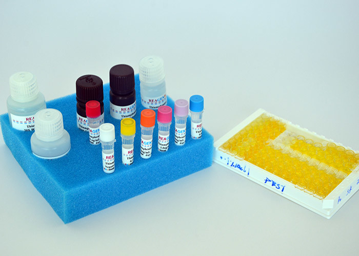Kit de ensayo enzimático de histamina de alta recuperación con tiempo ...